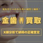 金歯の買取が不安な方へ｜X線分析で純度を見極め、納得の正確査定！