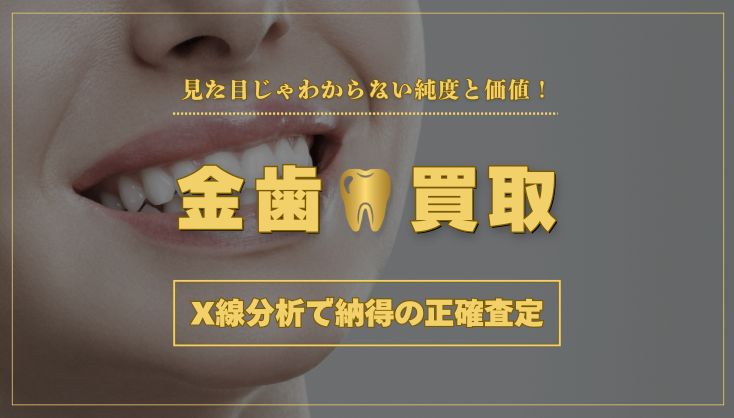 金歯 買取